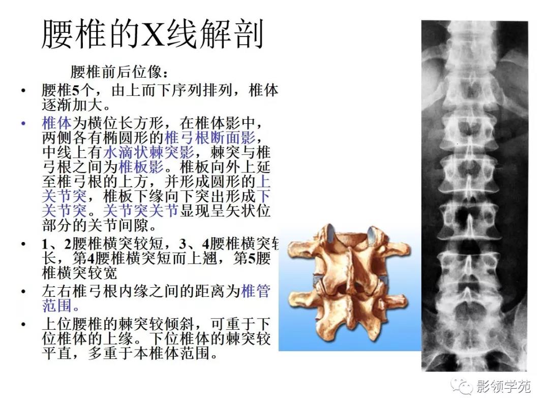 脊柱的x线解剖