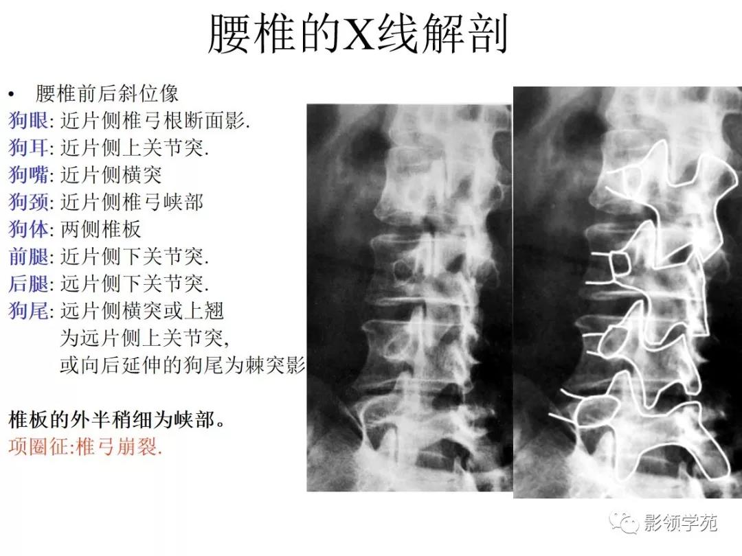 脊柱的x线解剖